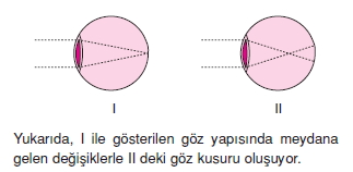 Duyuorganlarıcözümlütest1001