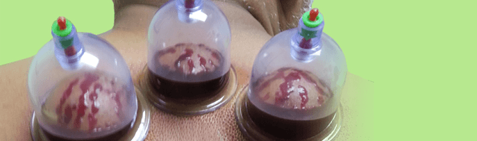 hacamat-nedir-ve-nasil-yapilir