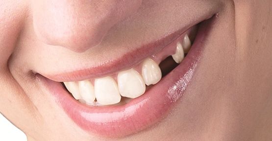 eksik_dis_hastalik_nedeni