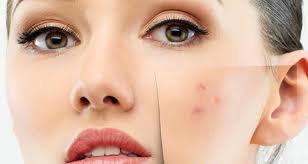 stresin-cilde-etkisi